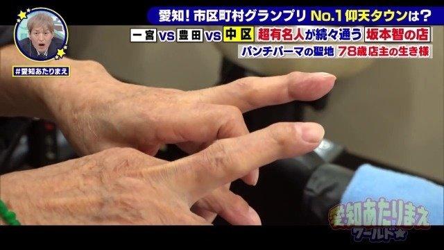 指はすっかり変形